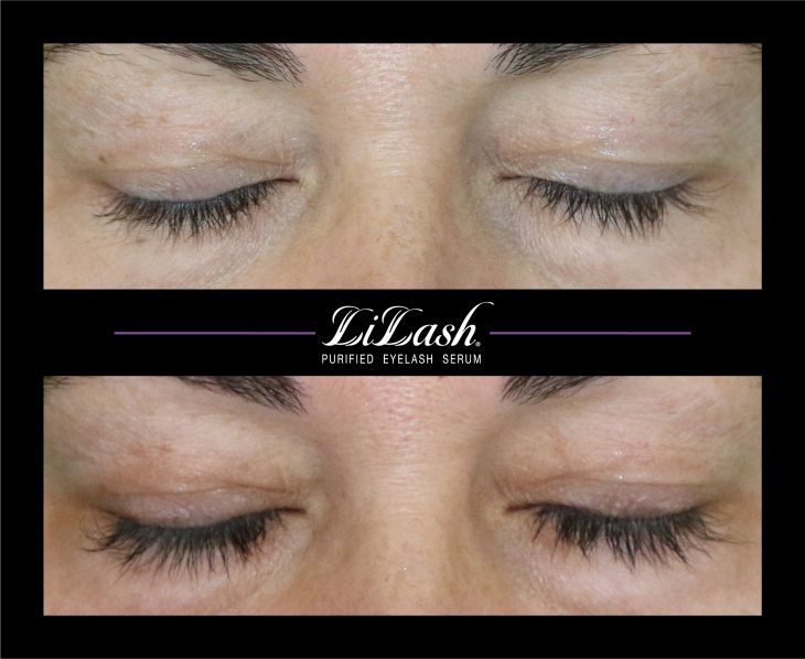 LiLash Purified Eyelash Serum - before and after